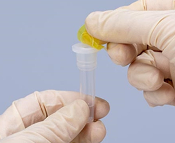 トップシールをはがす